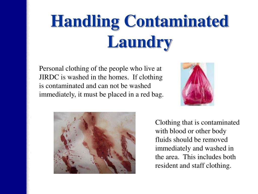 Where Should Dirty Linens Be Stored at Deborah Maloney blog