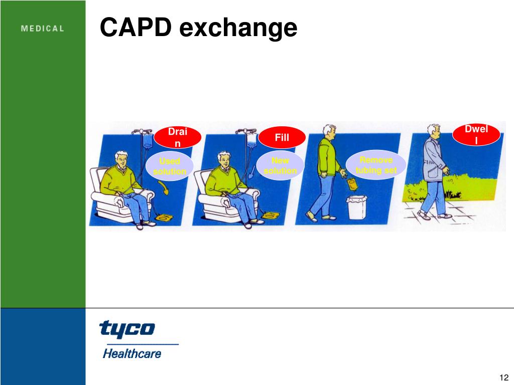 PPT Dialysis Access PowerPoint Presentation ID256384