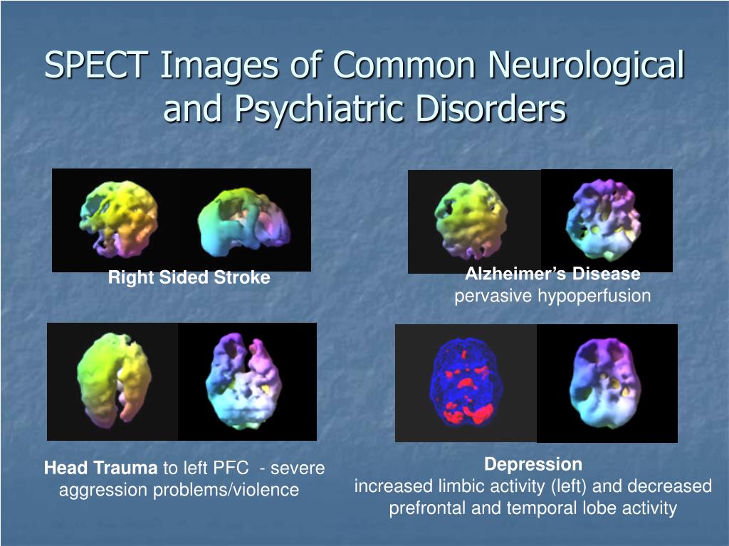PPT Diagnostic Uses of Radiopharmaceuticals PowerPoint Presentation, free download ID259321