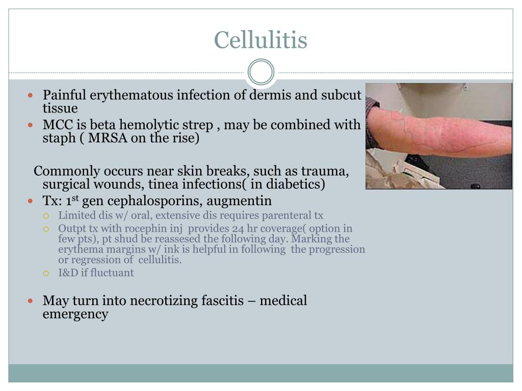 PPT COMMON SKIN INFECTIONS PowerPoint Presentation ID265856