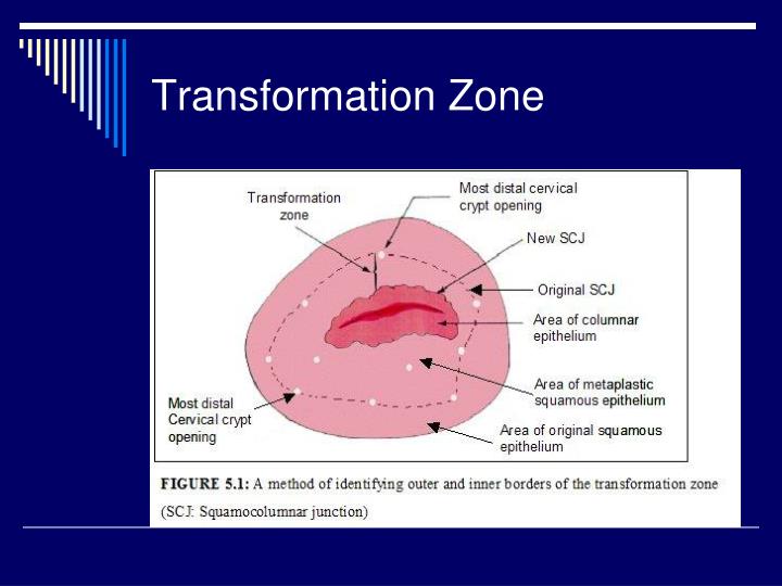 PPT Colposcopy PowerPoint Presentation ID275680