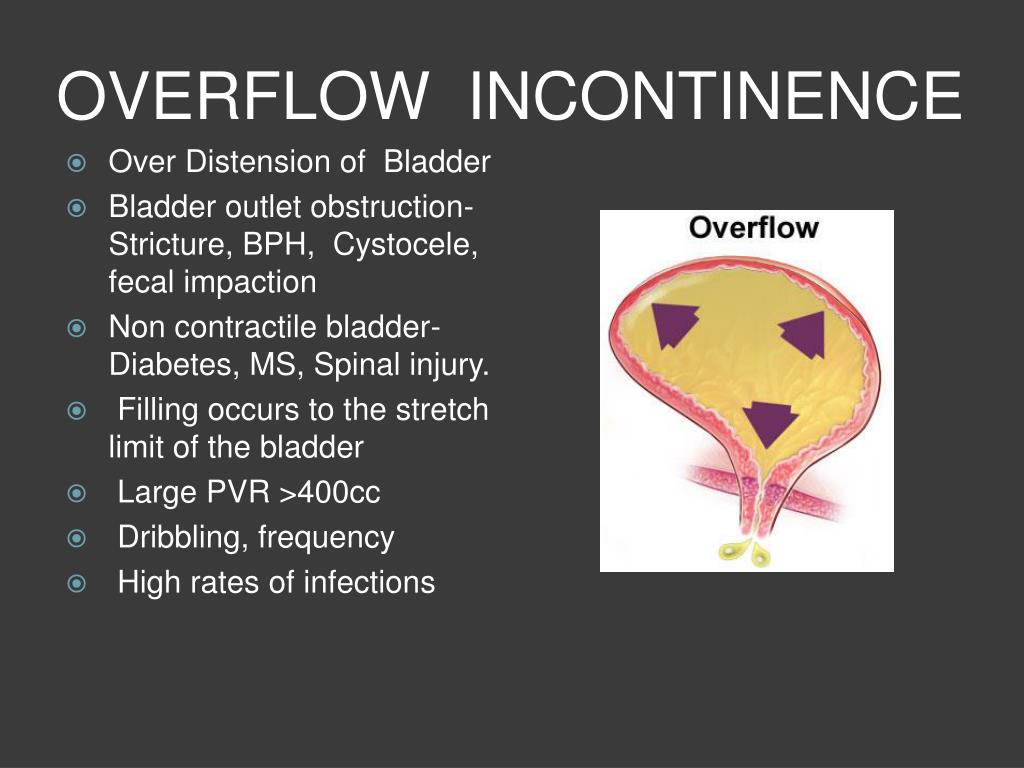 Overflow Incontinence Bowel Child at Michael Fitzpatrick blog