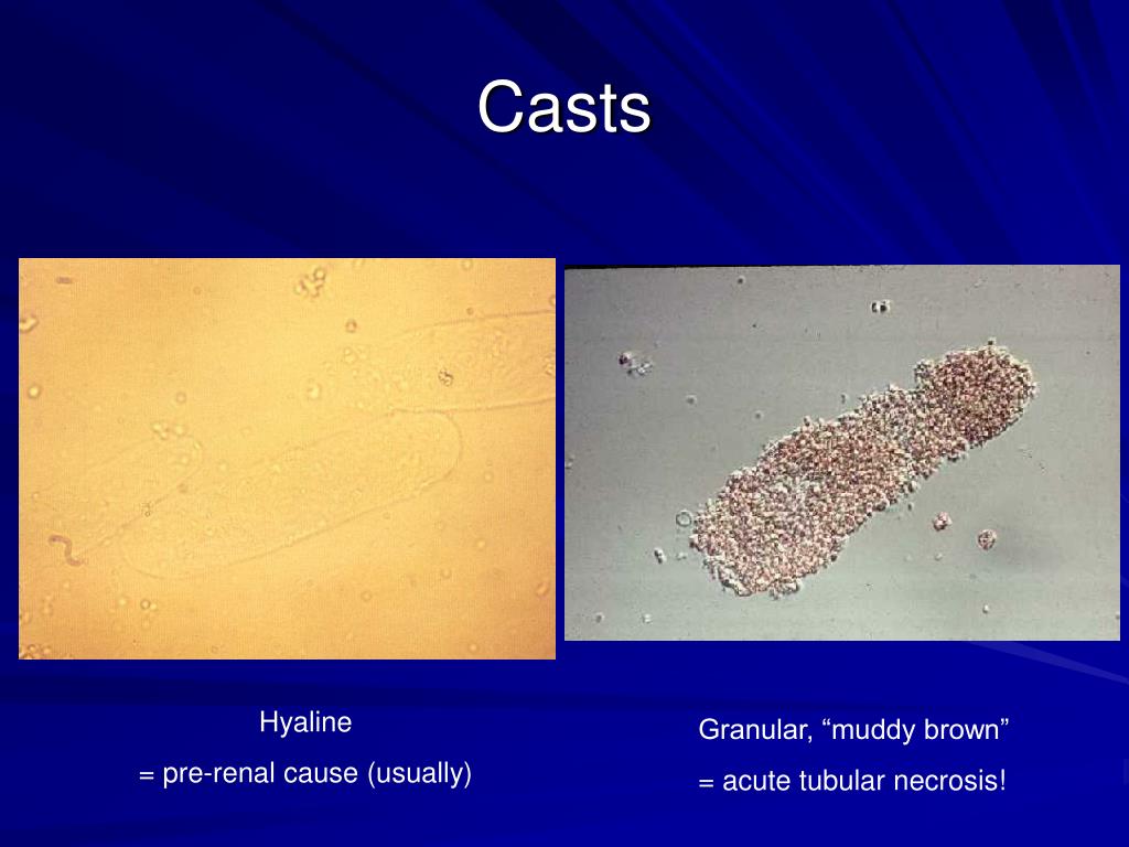 PPT Acute Renal Failure PowerPoint Presentation, free download ID