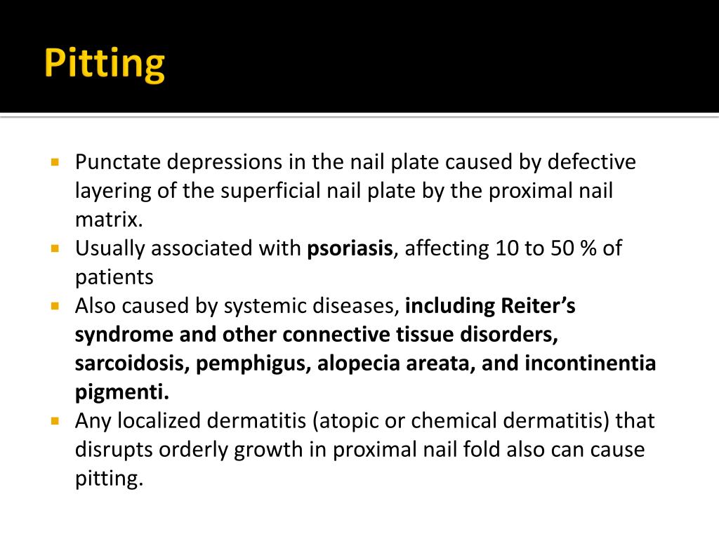 PPT Nail Disorders Clues to Systemic Disease PowerPoint Presentation