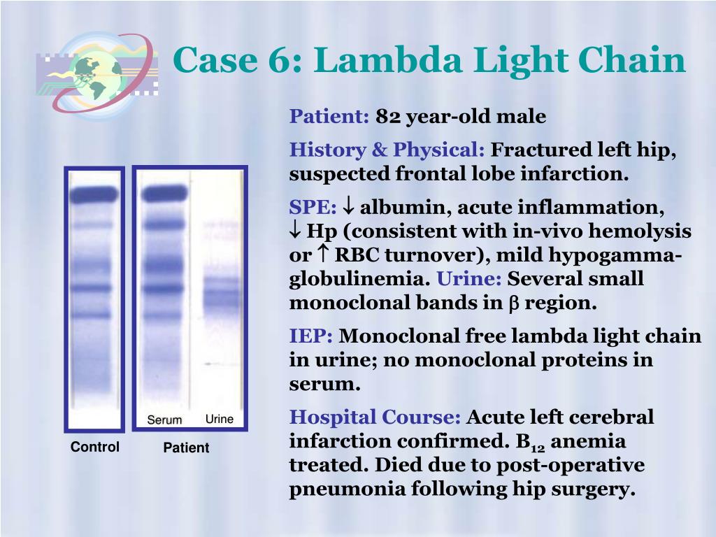 PPT High Resolution Protein Electrophoresis PowerPoint Presentation