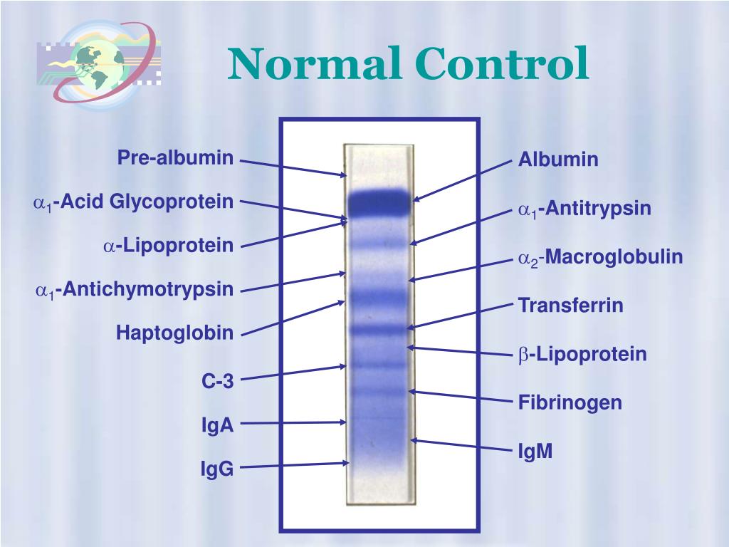 PPT High Resolution Protein Electrophoresis PowerPoint Presentation