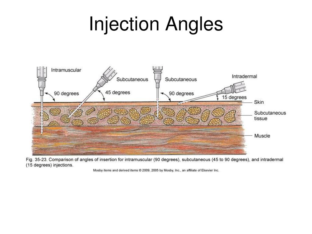 PPT Chapter 35 Medication Administration (Part 2) PowerPoint