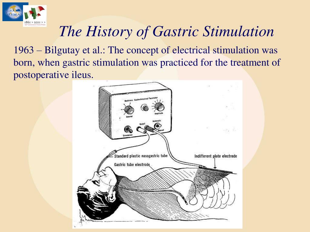PPT Gastroparesis and Gastric Electrical Stimulation PowerPoint