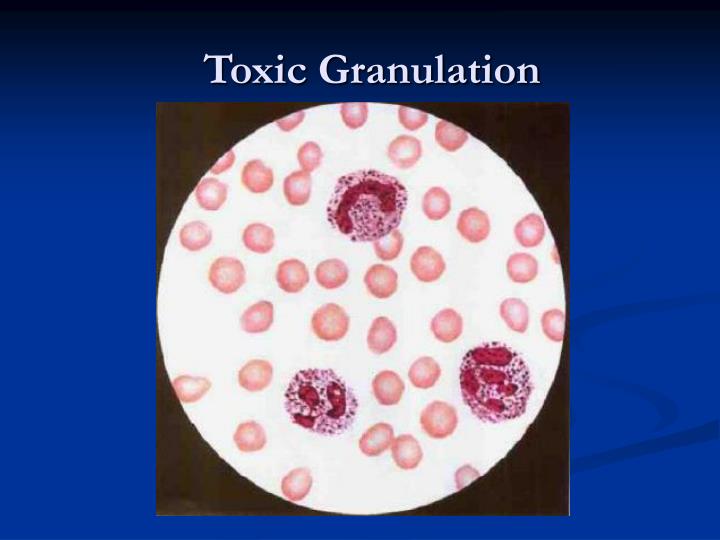 PPT White Blood Cell Differential Count PowerPoint Presentation ID