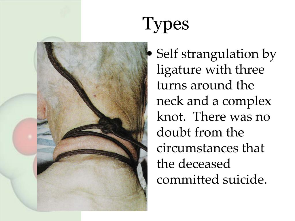 PPT Suffocation, Asphyxia, and Fatal Pressure on the Neck PowerPoint