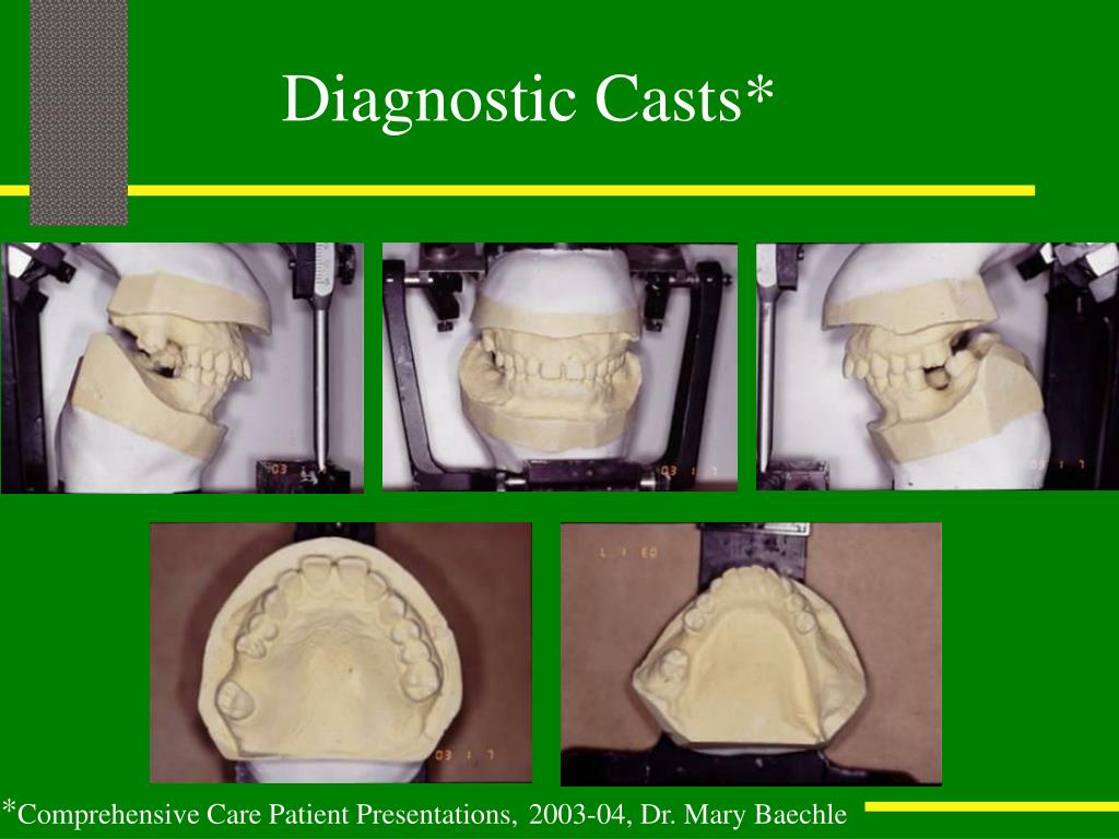 PPT TREATMENT PLANNING PROTOCOL FOR COMPLEX PROSTHODONTIC CASES