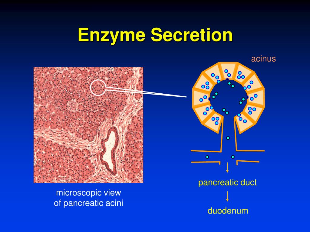 PPT Acute Pancreatitis PowerPoint Presentation, free download ID312017