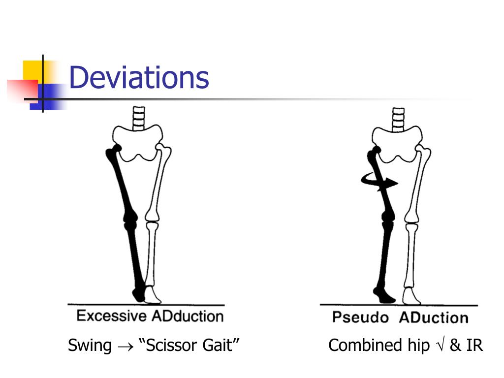 PPT Pathological Gait PowerPoint Presentation, free download ID313215