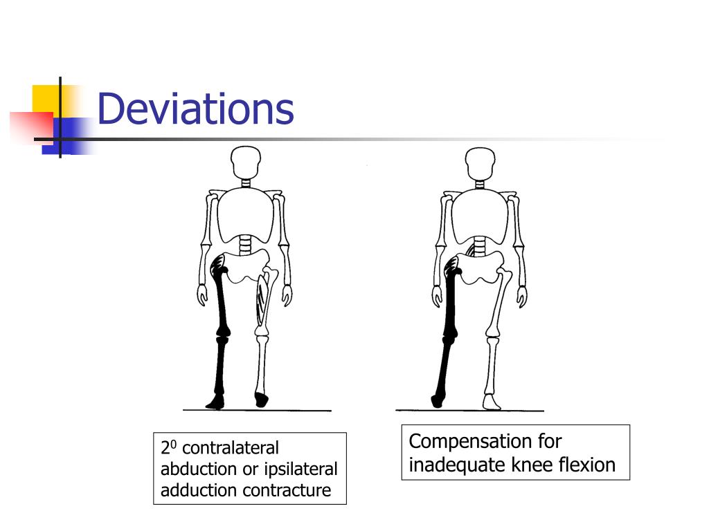 PPT Pathological Gait PowerPoint Presentation ID313215
