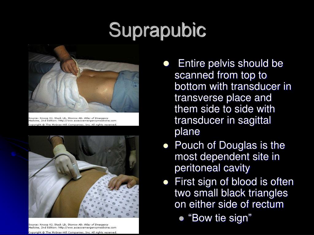 PPT FAST Exam PowerPoint Presentation ID319686