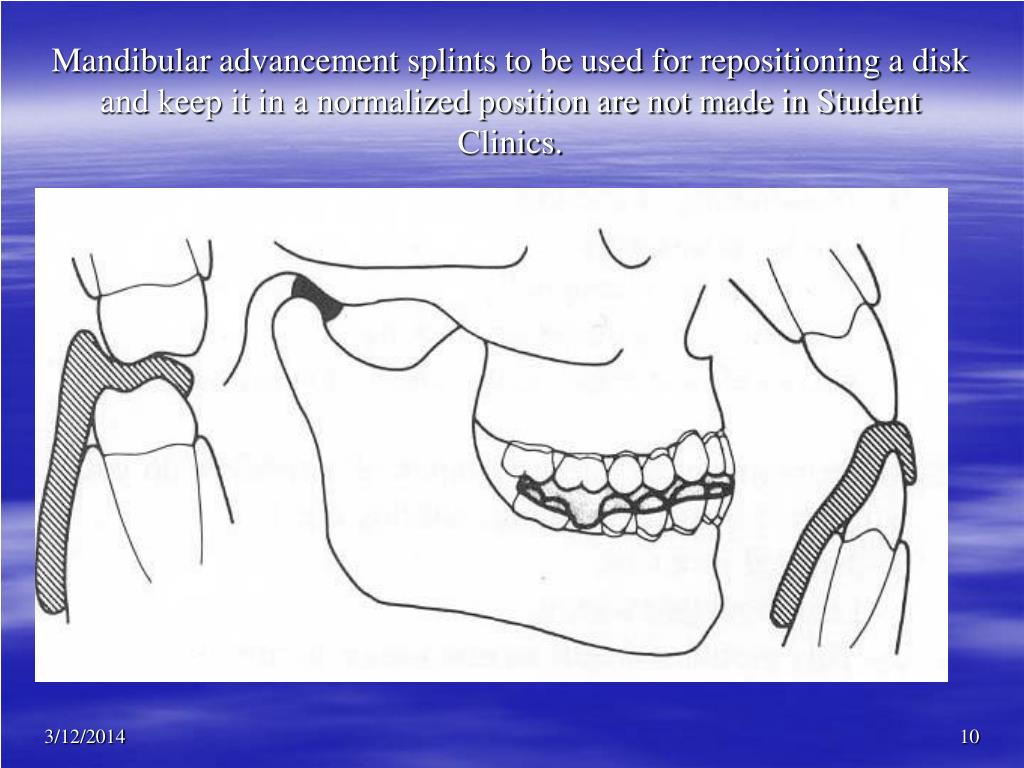PPT Occlusal splint maintenance, TMJ sound, and EMG recording in