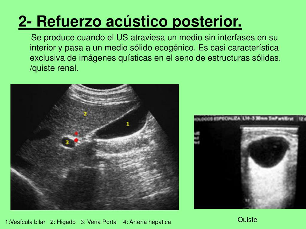 PPT CURSO DE ECOGRAFIA ”pa principiantes” PowerPoint Presentation