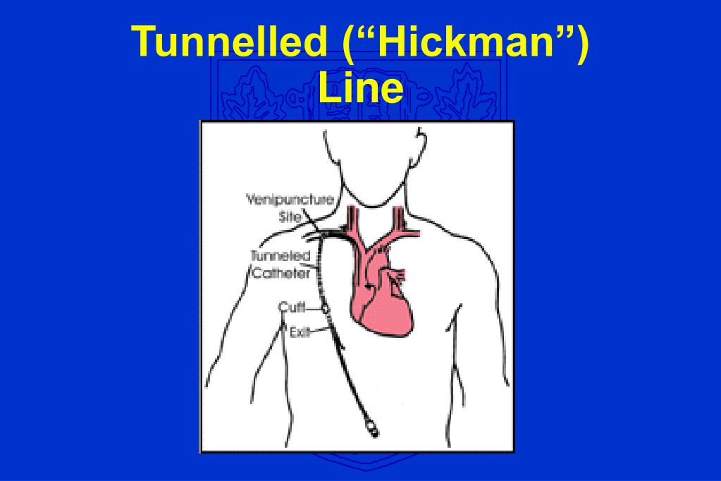 PPT Parenteral Nutrition An Overview for the Practising Clinician