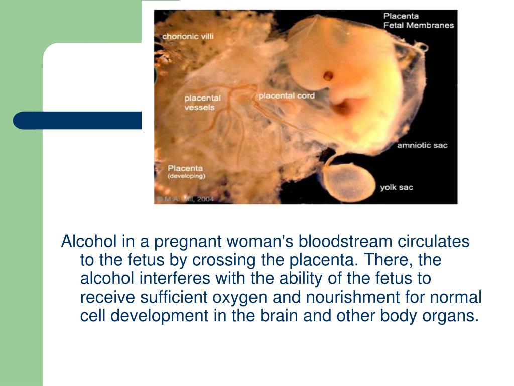 PPT Fetal Alcohol Spectrum Disorders PowerPoint Presentation, free