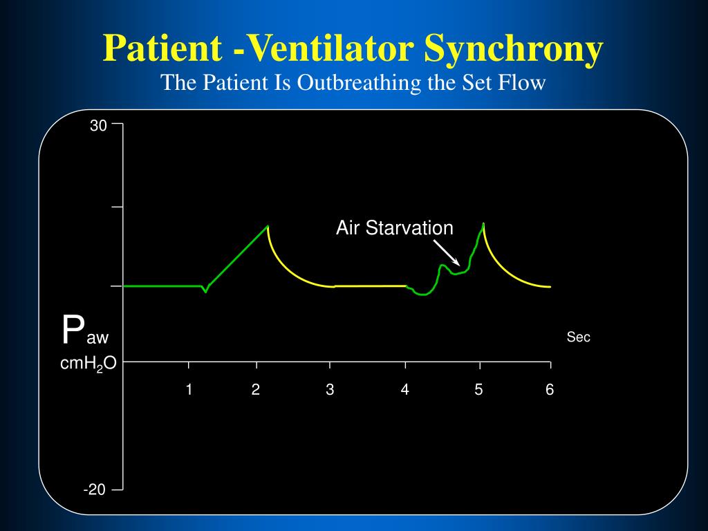 PPT BASICS OF WAVEFORM INTERPRETATION PowerPoint Presentation, free