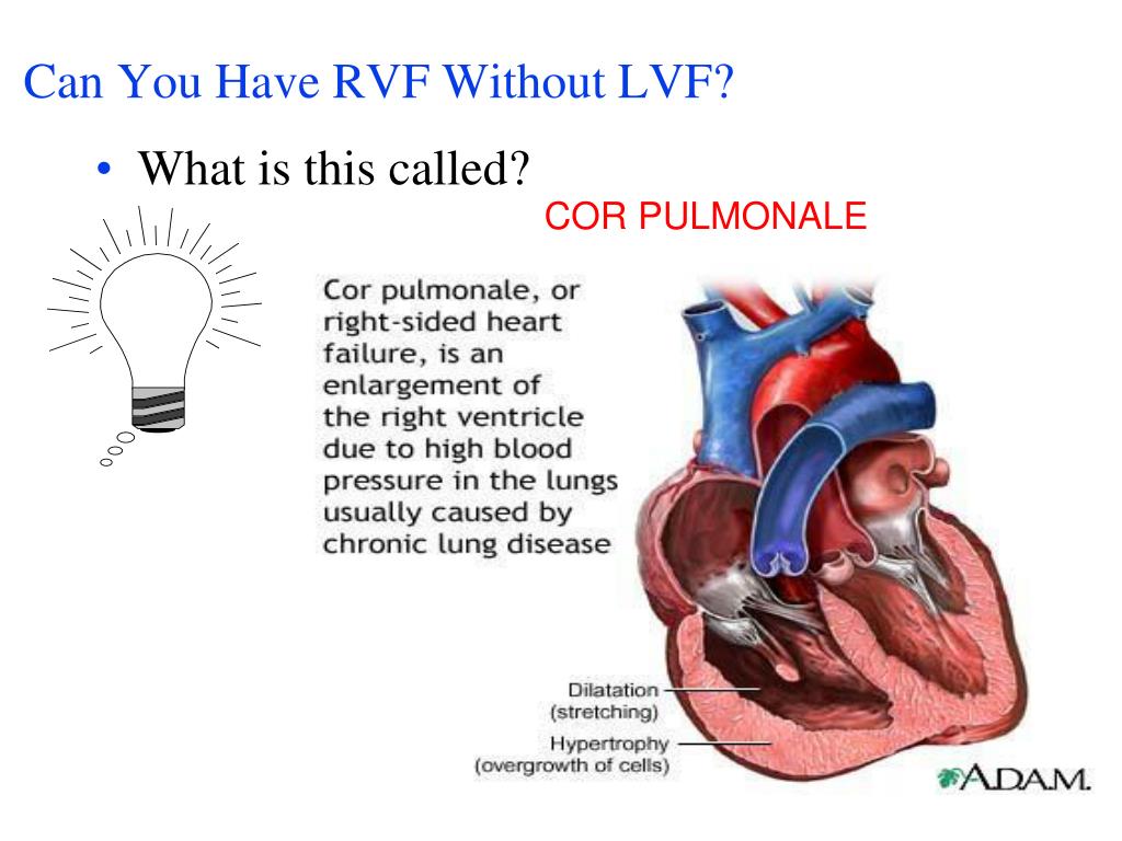 PPT Heart Failure PowerPoint Presentation, free download ID325739 PPT Heart Failure PowerPoint Presentation, free download ID325739