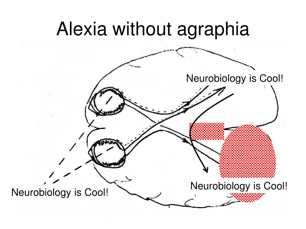 PPT Association Cortex, Asymmetries, and Cortical Localization of