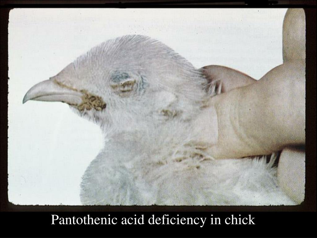 PPT Vitamin Deficiency Symptoms PowerPoint Presentation, free