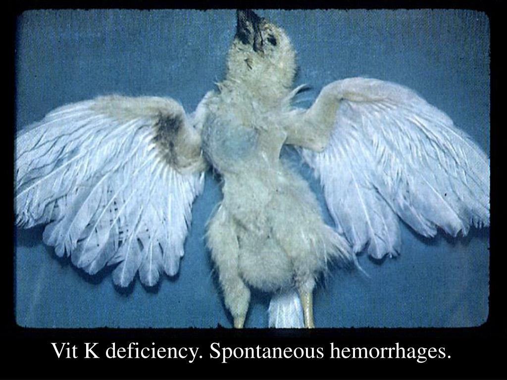 PPT Vitamin Deficiency Symptoms PowerPoint Presentation, free download ID32969