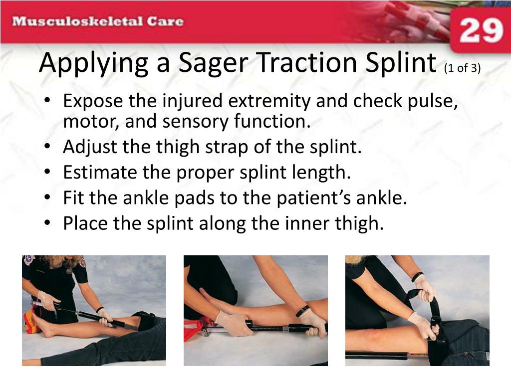 PPT Applying a Hare Traction Splint (3 of 3) PowerPoint Presentation