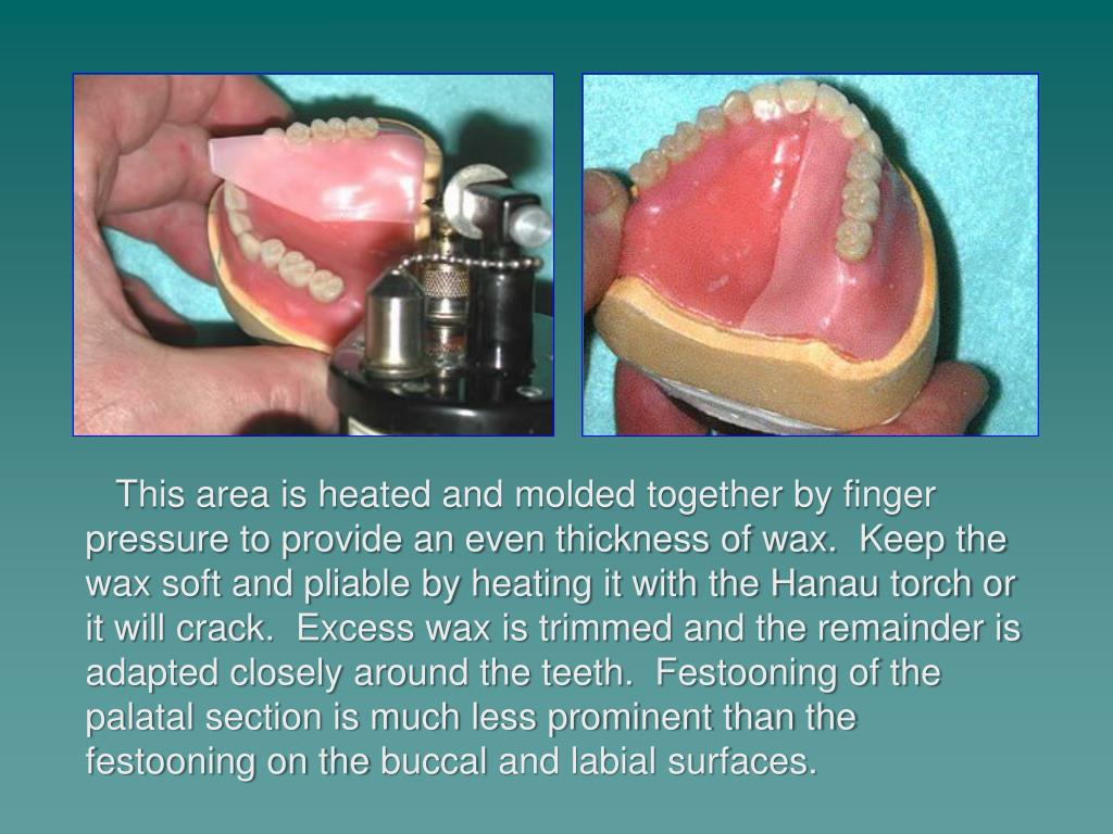 PPT Festooning and Stippling Dr. William G. Golden Director of