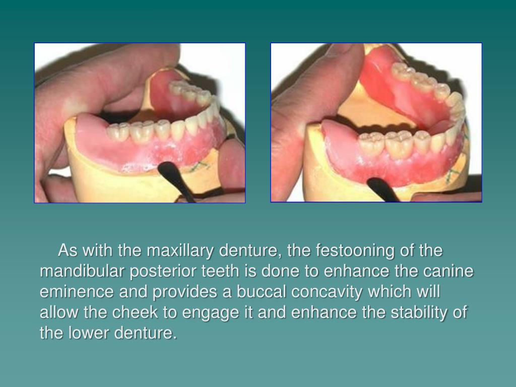 PPT Festooning and Stippling Dr. William G. Golden Director of