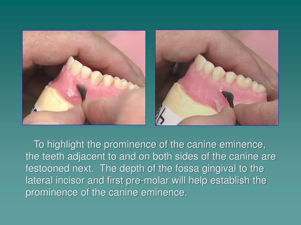 PPT Festooning and Stippling Dr. William G. Golden Director of