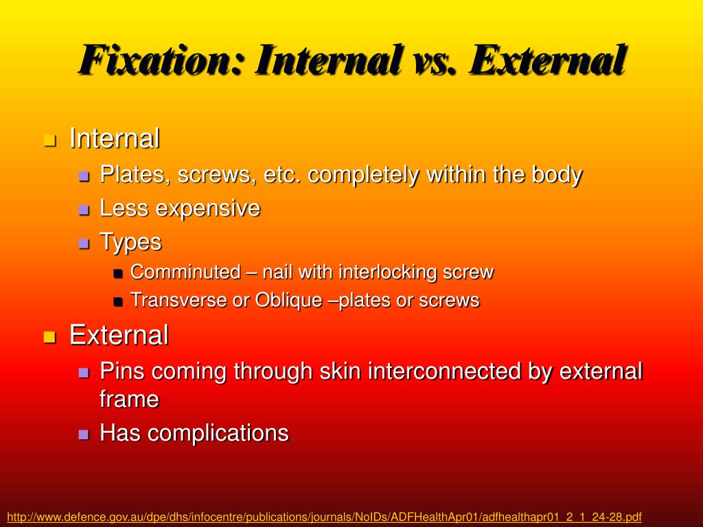 PPT Fracture Fixation Internal & External PowerPoint Presentation