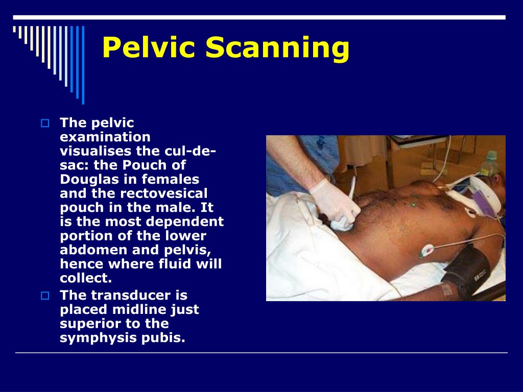 PPT Ultrasound in Emergency Medicine PowerPoint Presentation, free