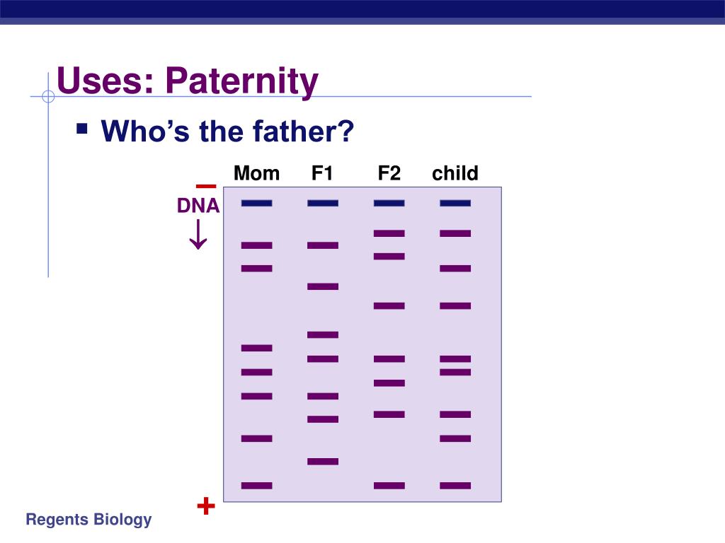PPT Biotechnology Gel Electrophoresis PowerPoint Presentation, free