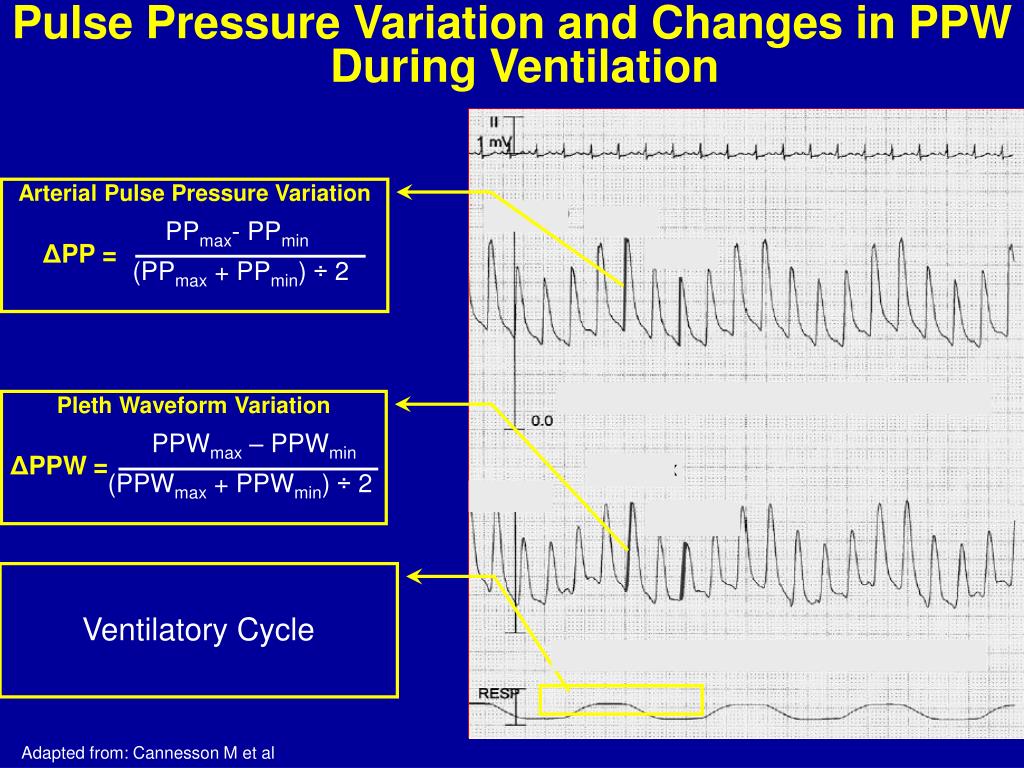 PPT Noninvasive and Continuous Fluid Responsiveness Monitoring with