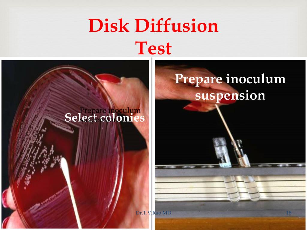 PPT ANTIBIOTIC SENSITIVITY TESTING SKILL BASED LEARNING PowerPoint