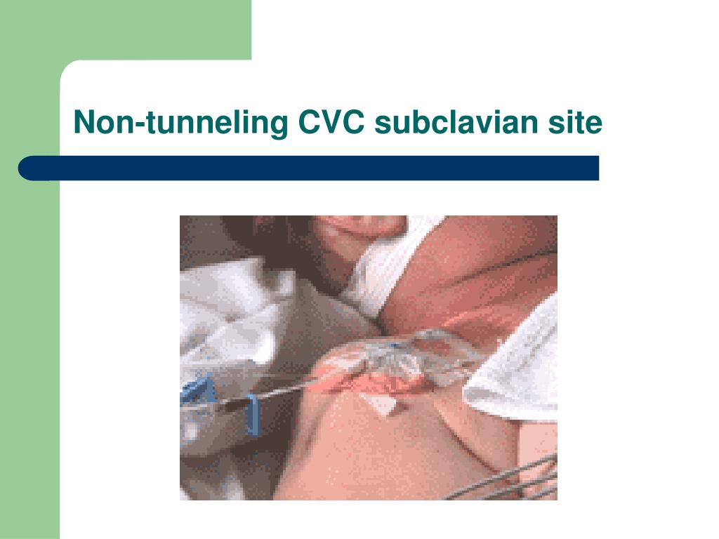 PPT Venous Access PowerPoint Presentation ID349907