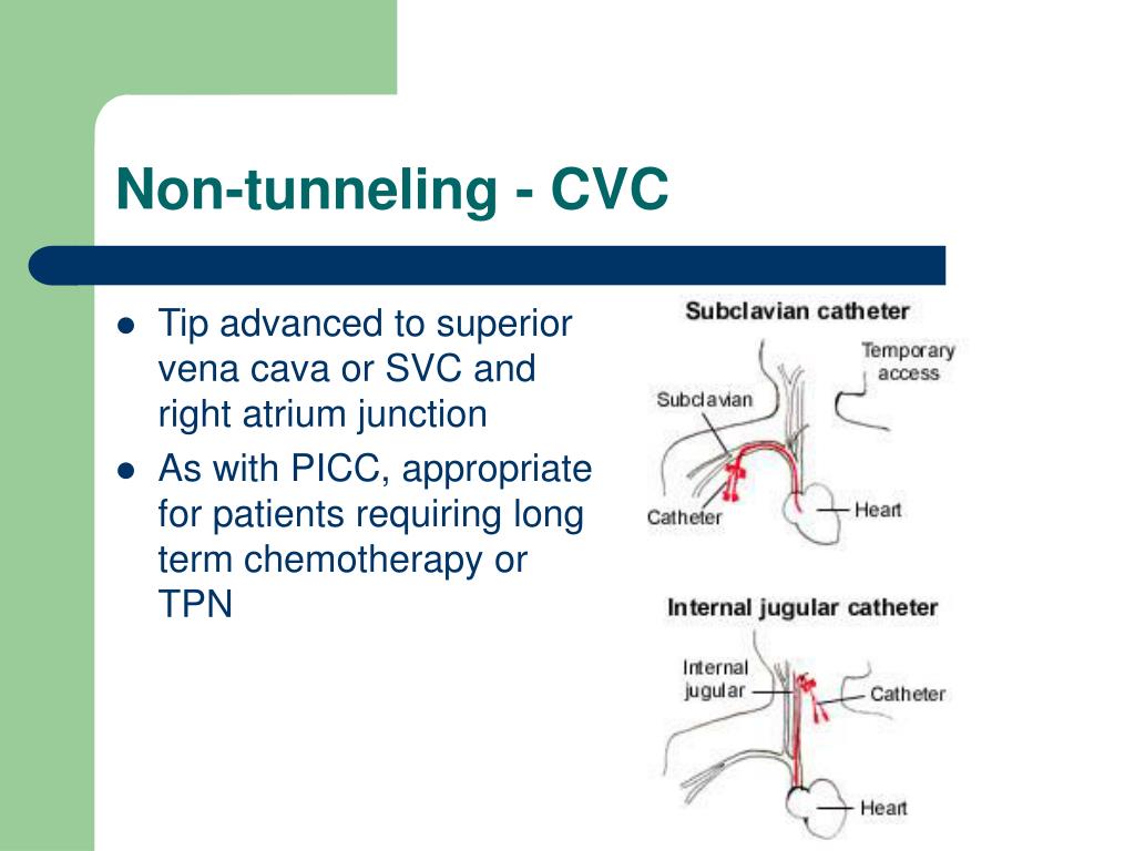 PPT Venous Access PowerPoint Presentation, free download ID349907