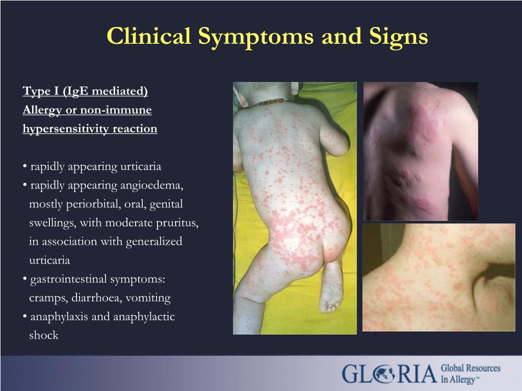 PPT GLORIA Module 11 Drug Allergy (Part 2) Clinical Management of