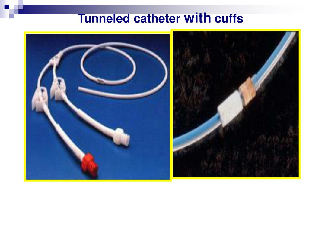PPT IV TERAPY & Central Venous Catheters PowerPoint Presentation ID