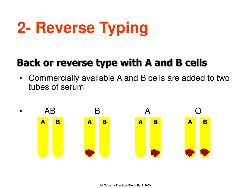 PPT Blood Grouping Slide & Tube Methods PowerPoint Presentation ID