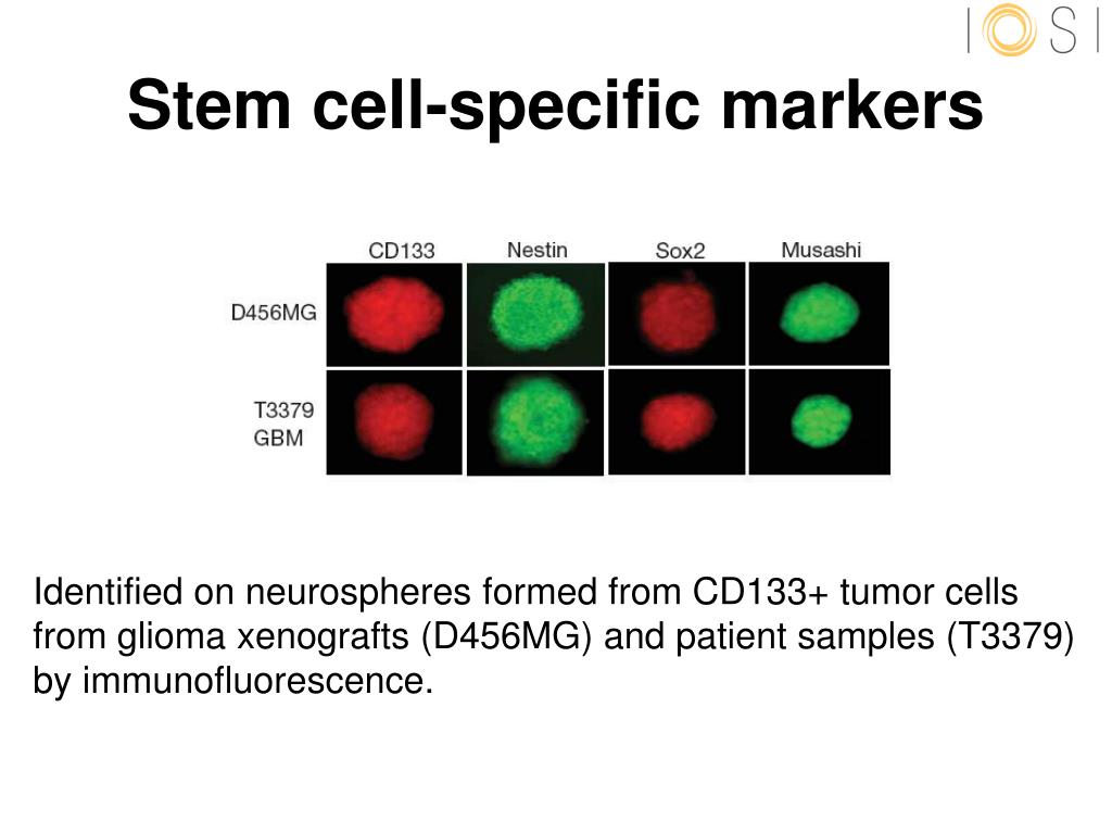 PPT Cancer stem cells PowerPoint Presentation, free download ID361286
