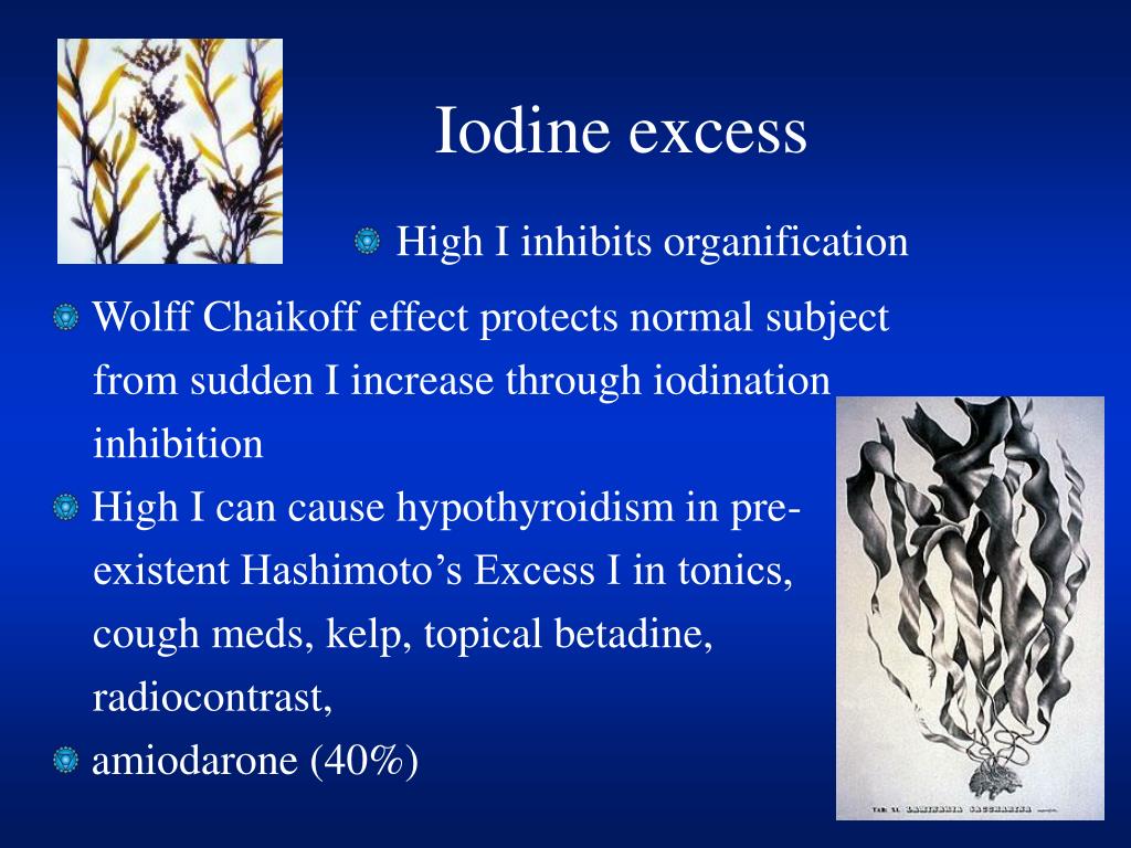 PPT Hypothyroidism PowerPoint Presentation, free download ID361727