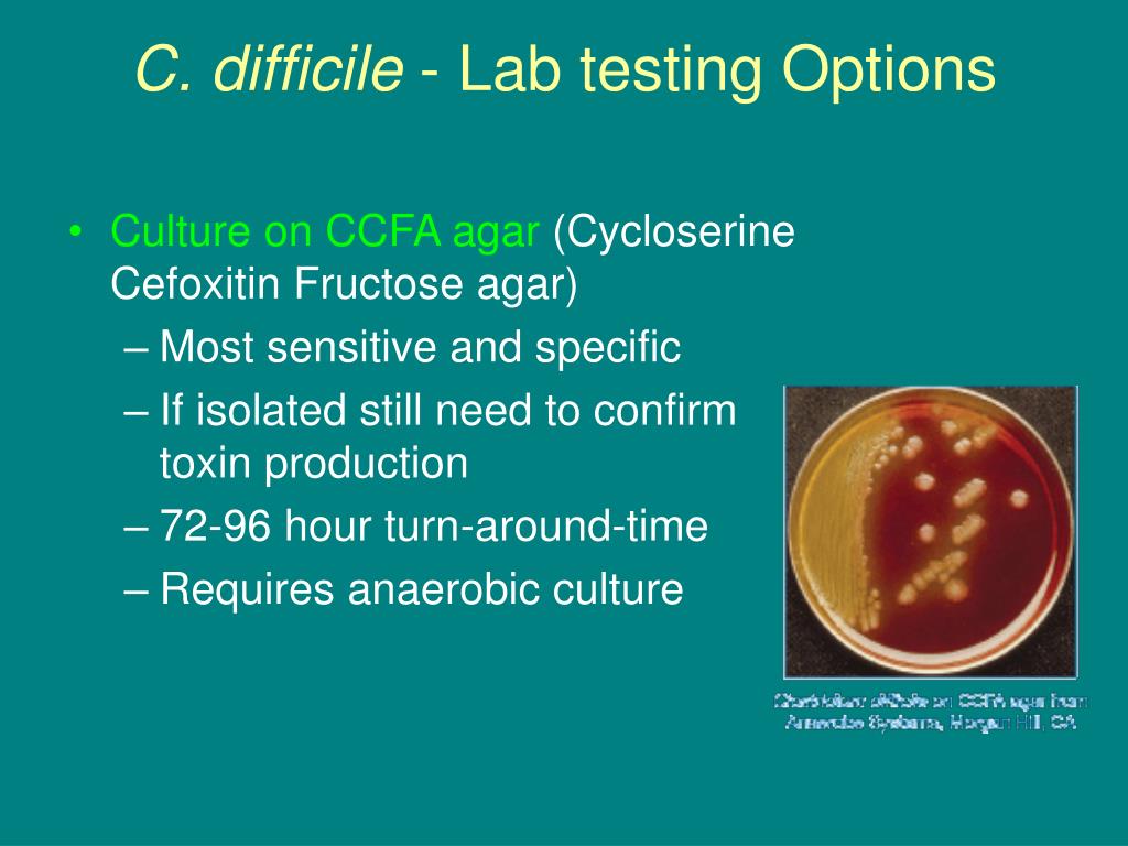 PPT Clostridium difficile Shifting Sands of a Pesky Pathogen