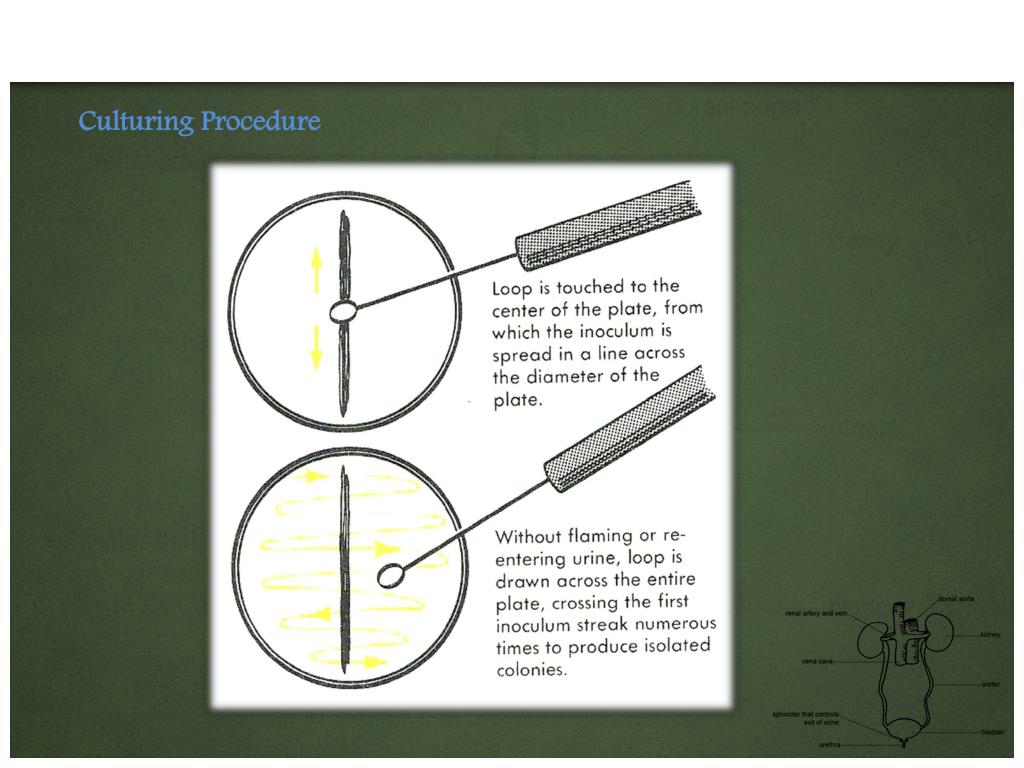 PPT Urine culture PowerPoint Presentation, free download ID370767