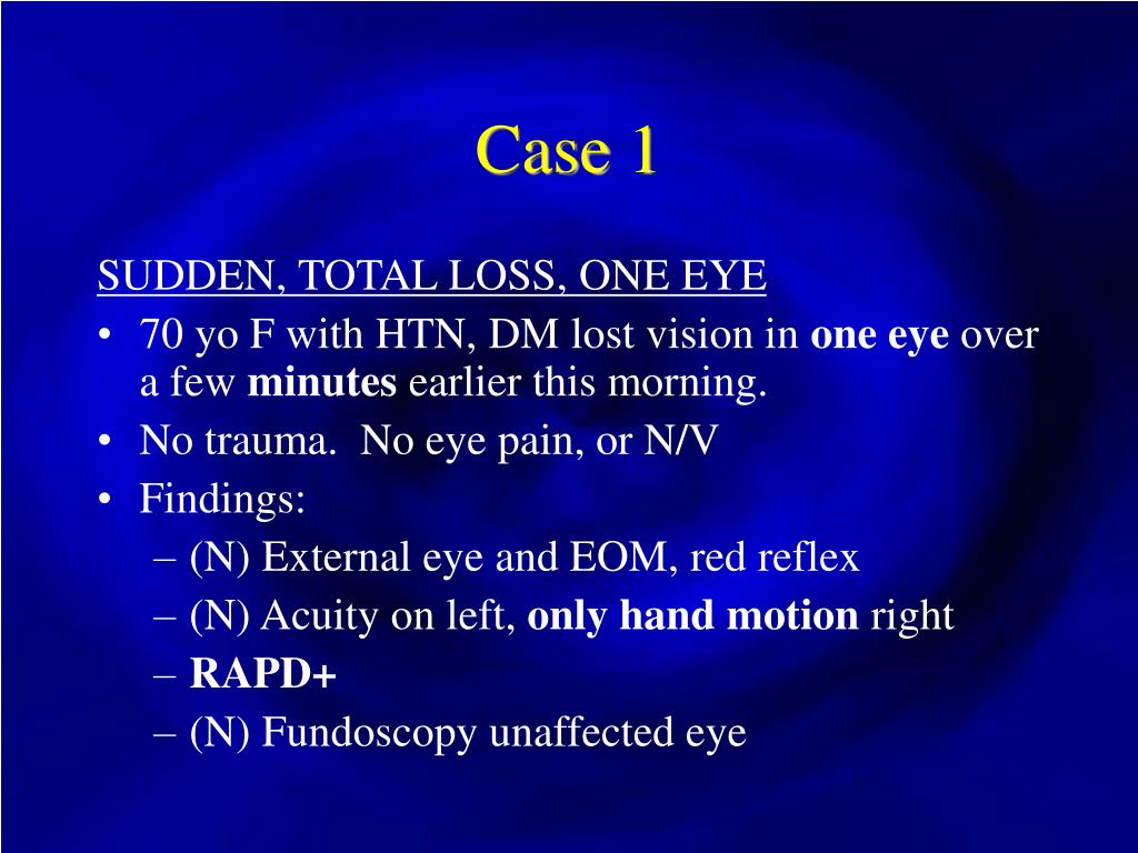 PPT Vision Loss PowerPoint Presentation, free download ID372182