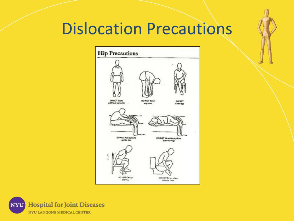 PPT ARTHRITIS OF THE HIP PowerPoint Presentation, free download ID