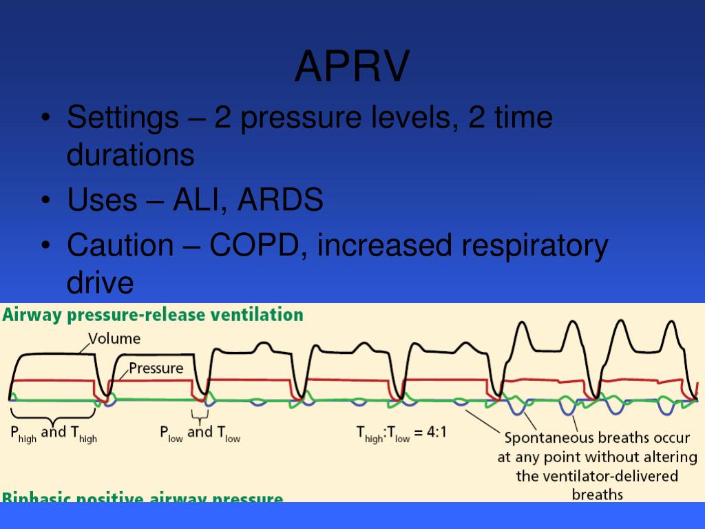 PPT Mechanical Ventilation PowerPoint Presentation, free download