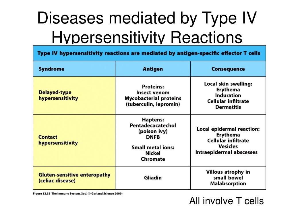 PPT Type 4 Hypersensitivity and Autoimmunity Chang Kim PowerPoint